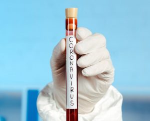 У Гродне адкрыюць другую ў вобласці лабараторыю па тэставанні на каранавірус. На Гродзеншчыне - новыя ачагі