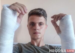 У журналиста Hrodna.Life Руслана Кулевич переломы обеих рук У журналиста Hrodna.Life Руслана Кулевич переломы обеих рук
