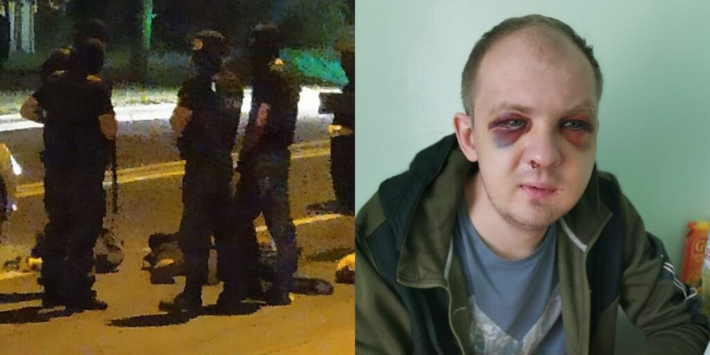 Збітага АМАПам таксіста абвясцілі ў вышук. Яму пагражае тры гады калоніі Алексей Лапа в момент задержания и в больнице