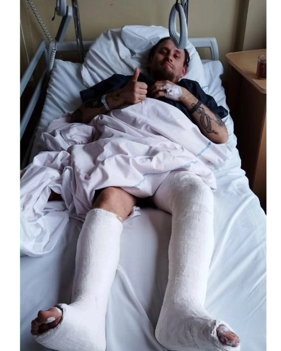 Музыкант из Гродно поломал ноги. Ему собирают деньги на больницу и реабилитацию